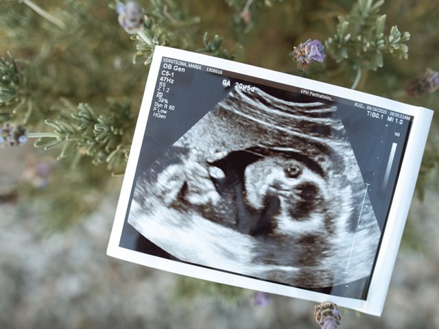 Exames de Ginecologia/ Obstetrícia